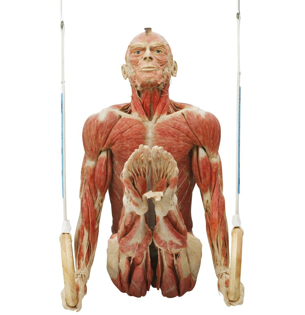 Plastinated Body